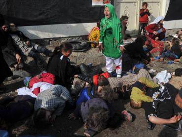 Attentat suicide à Kaboul, en décembre 2011. Cette fillette s'appelle Tarana et a 12 ans. 