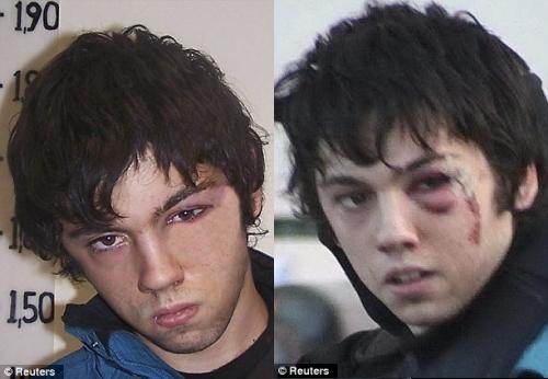 Andreas-Dimitris Bourzoukos, 23 ans, l’un des quatre militants anarchistes torturés par la police. Avant et après... Andreas-Dimitris Bourzoukos, 23 ans, l’un des quatre militants anarchistes torturés par la police. Avant et après...