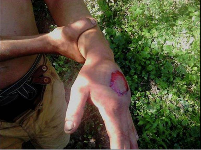 Photo de la main d&#039;un militant qui dit avoir été touché par un tir de Flashball le 10 spetembre 2014.