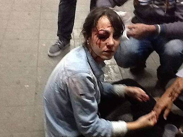 La journaliste de la Folha de Sao Paulo, blessée par des flics