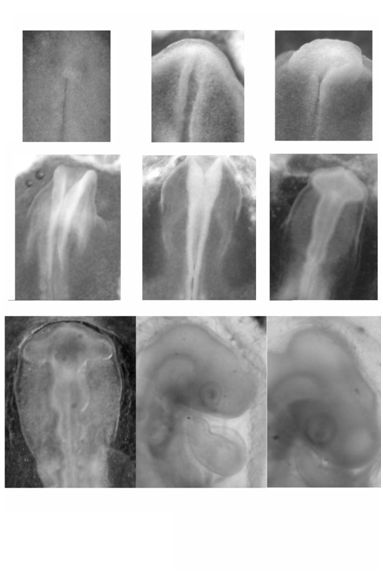 Stades progressifs de la formation des yeux