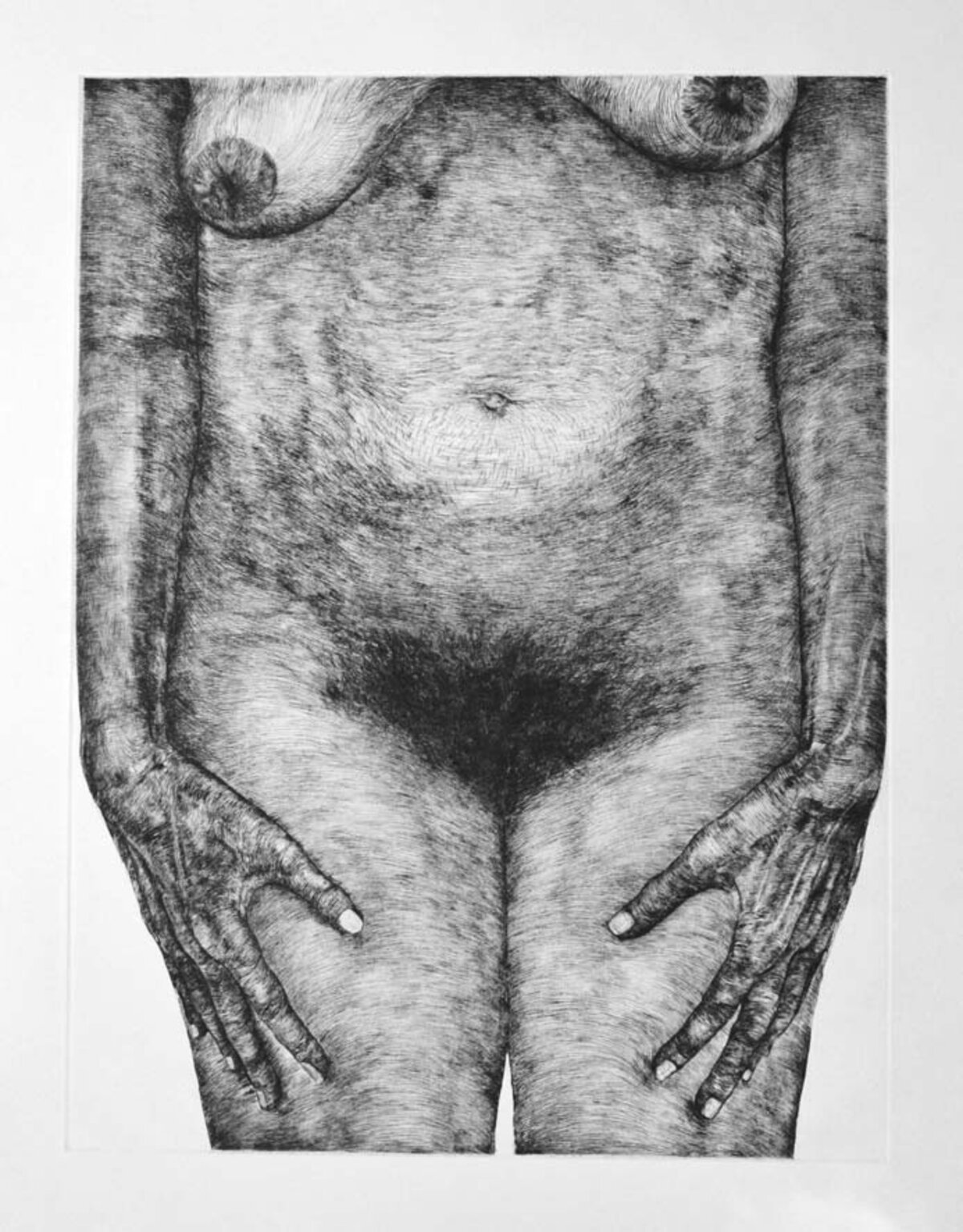 Illustration 1