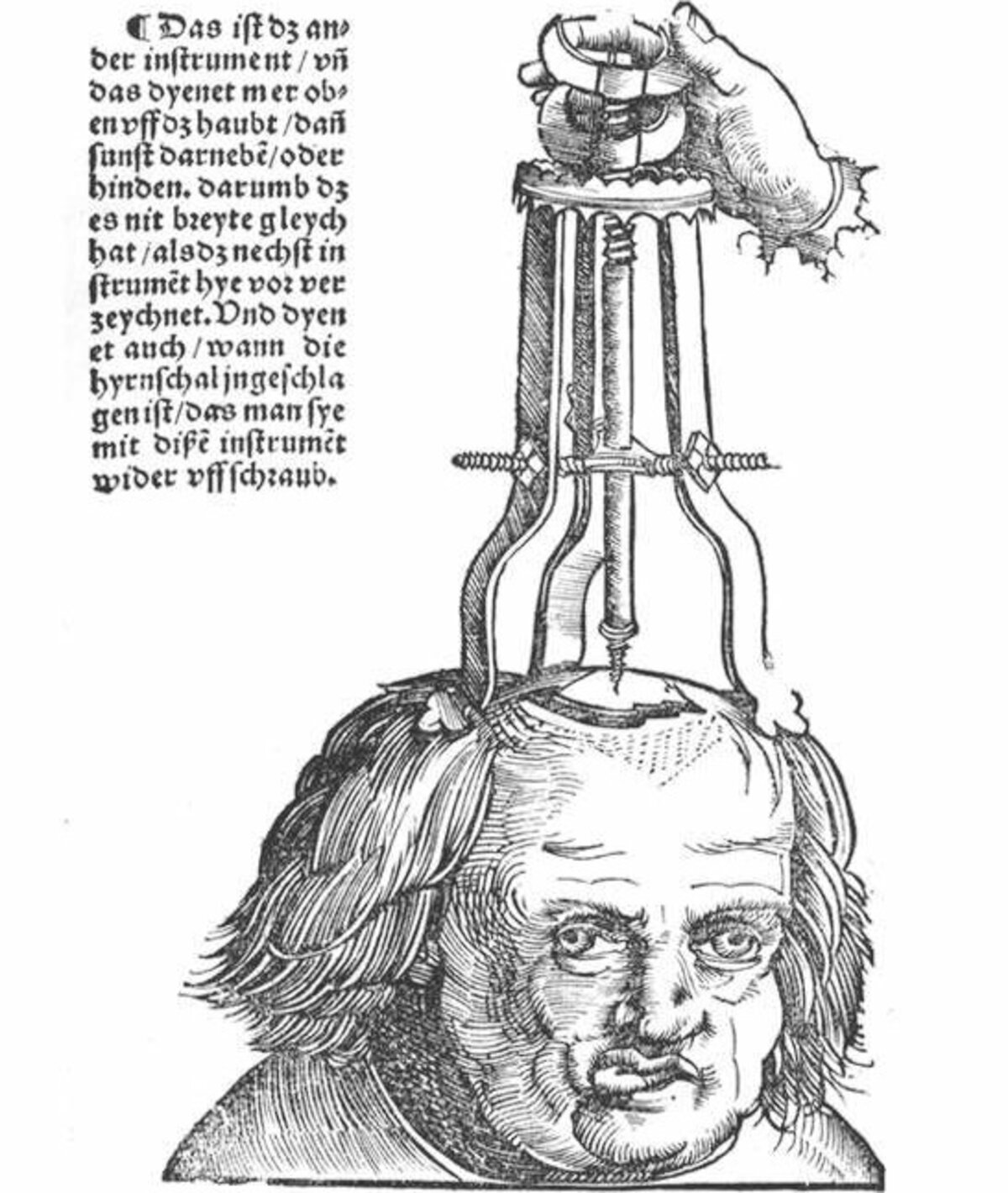 Illustration 1