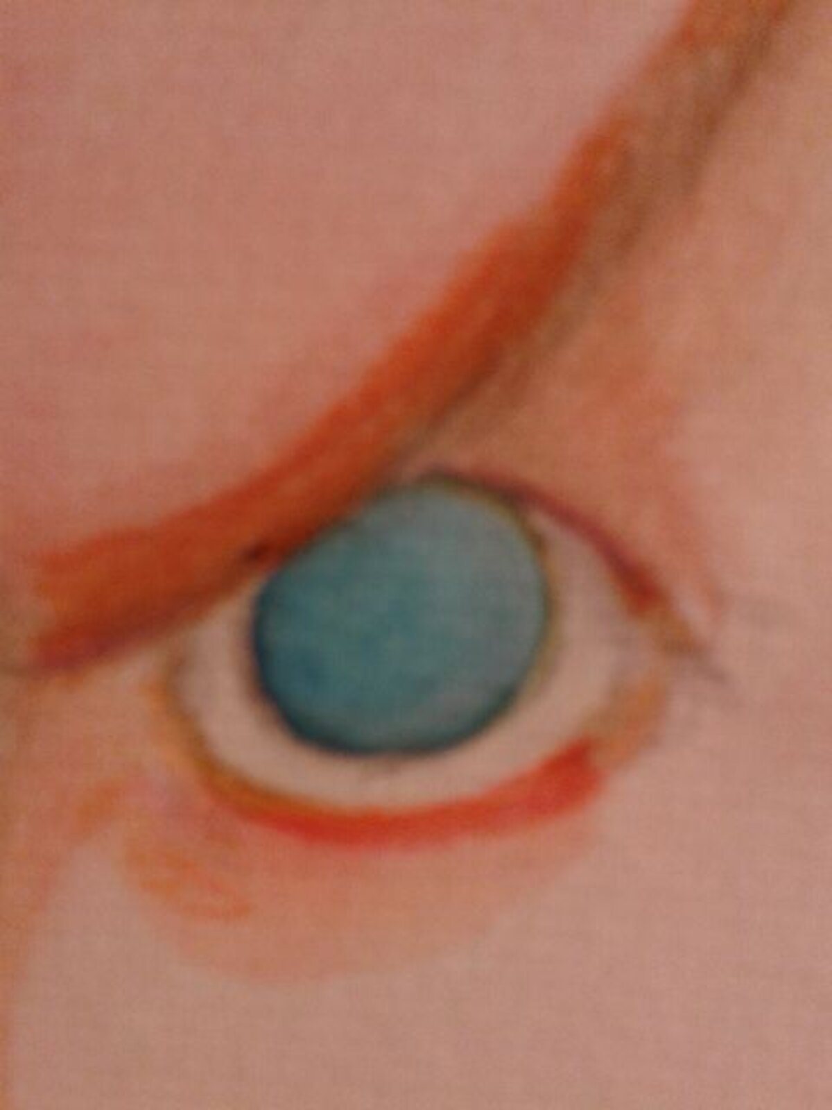 Illustration 1