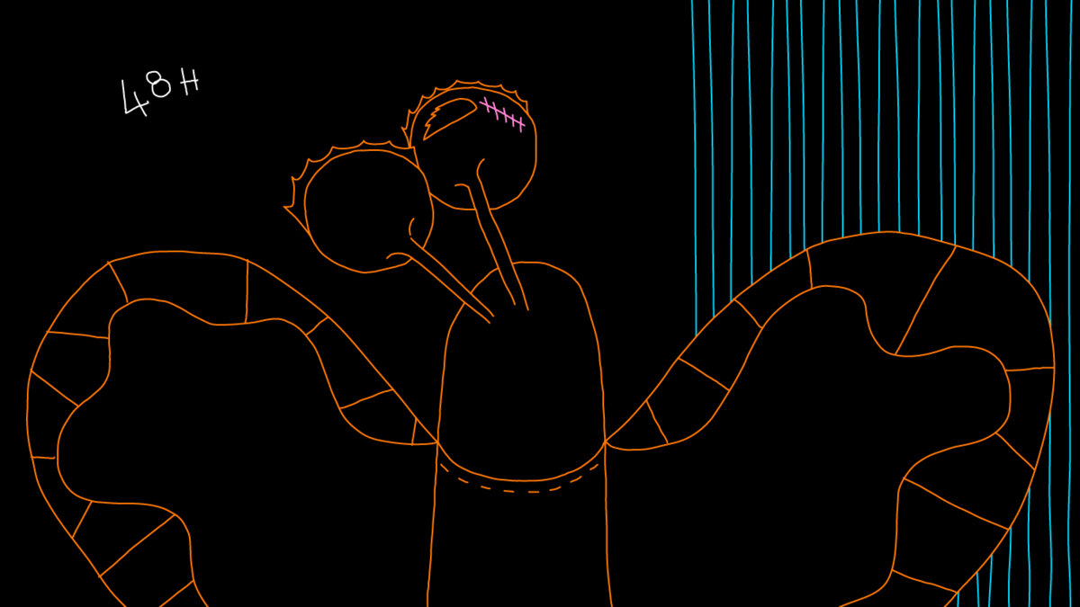Illustration 1