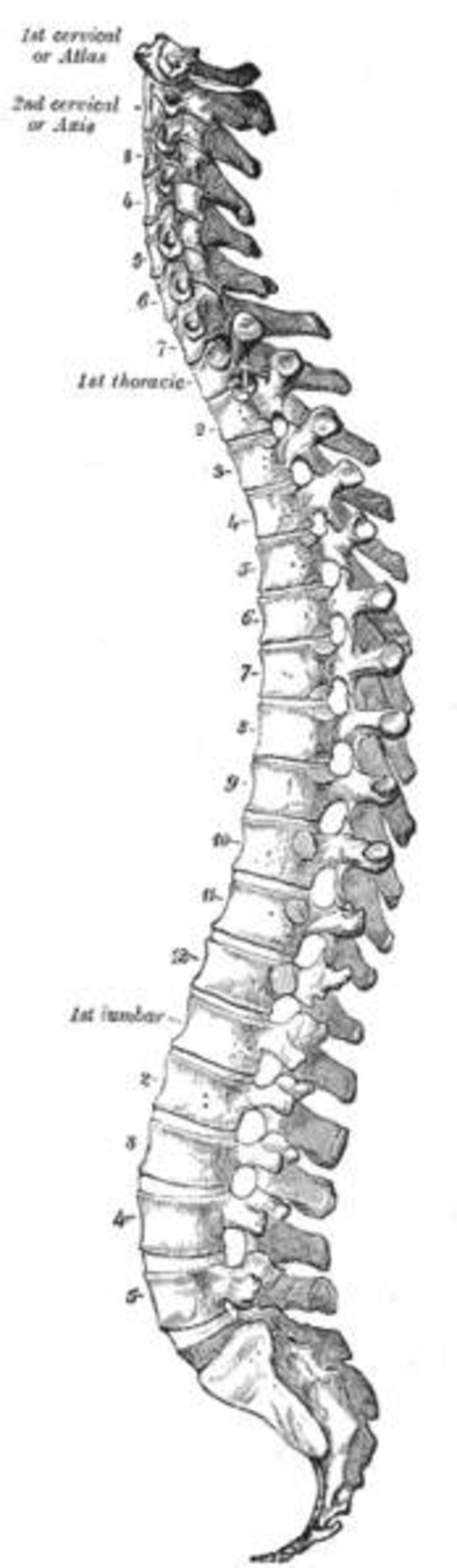 Illustration 1