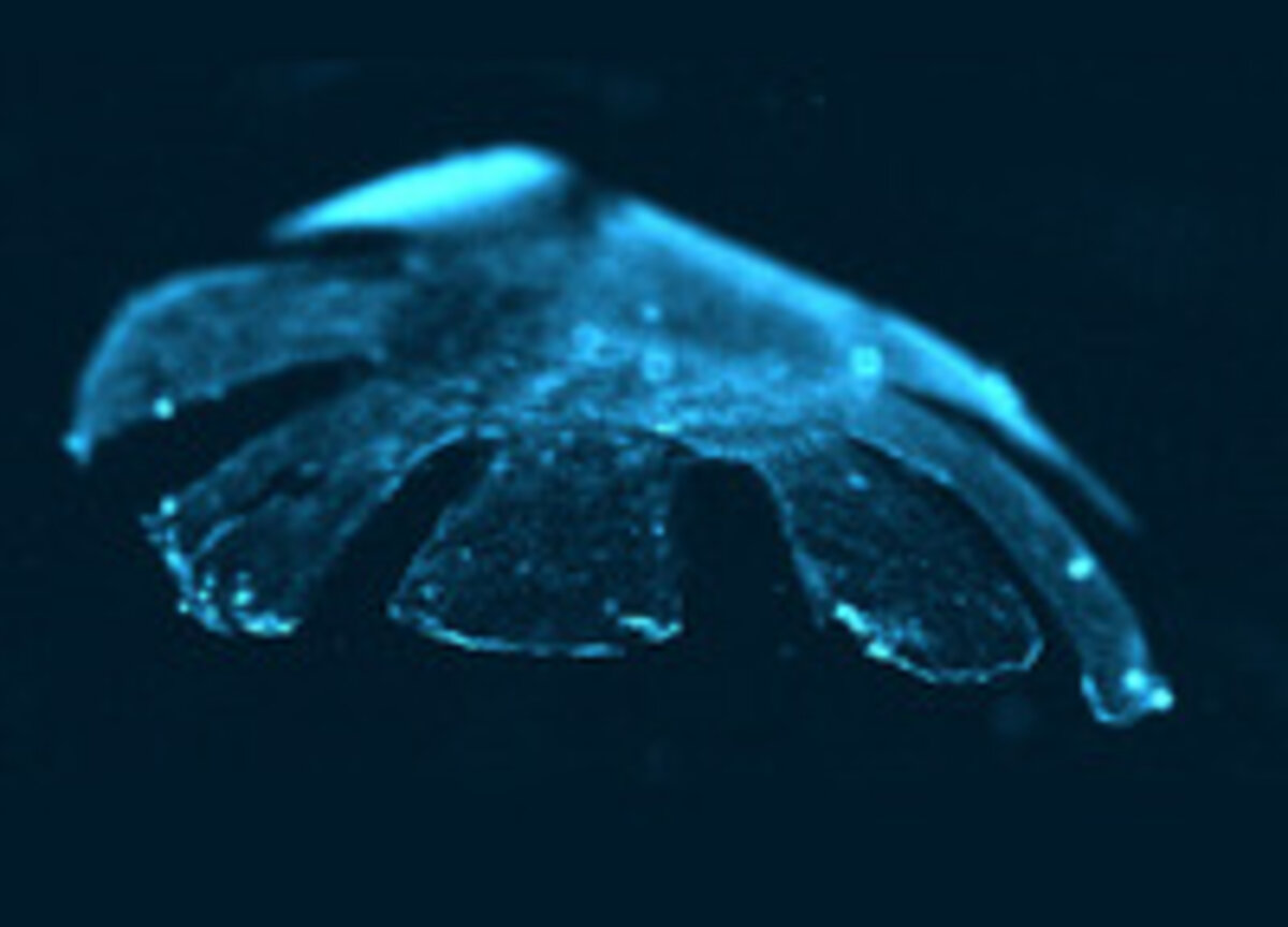 Illustration 1