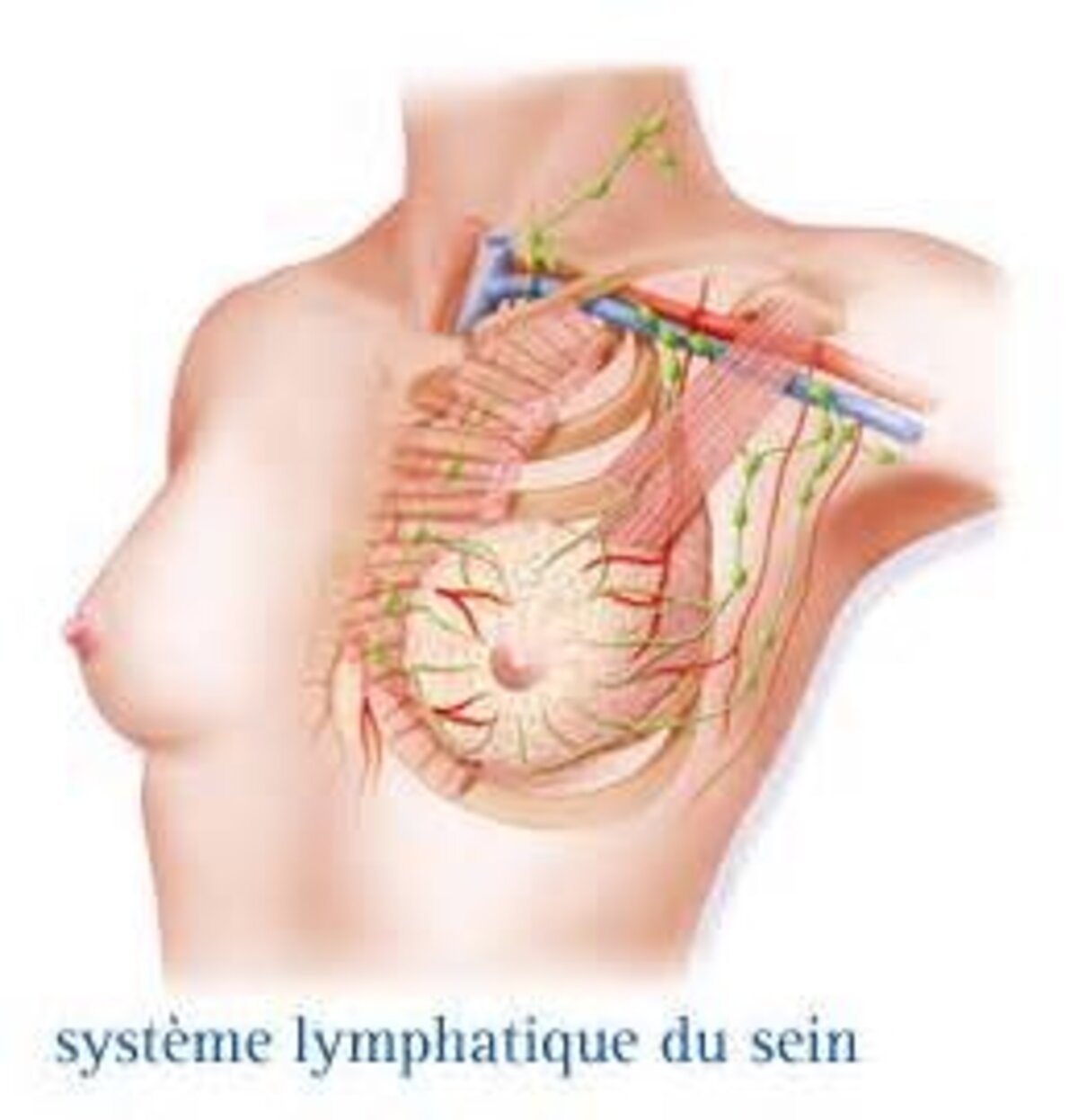 Illustration 1