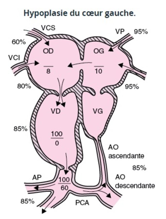 Illustration 6