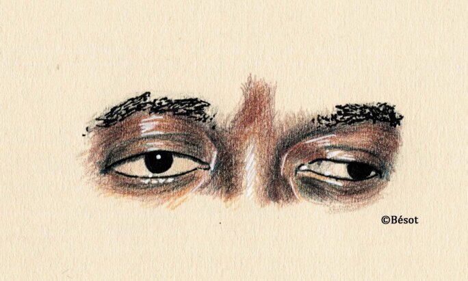 Illustration 4