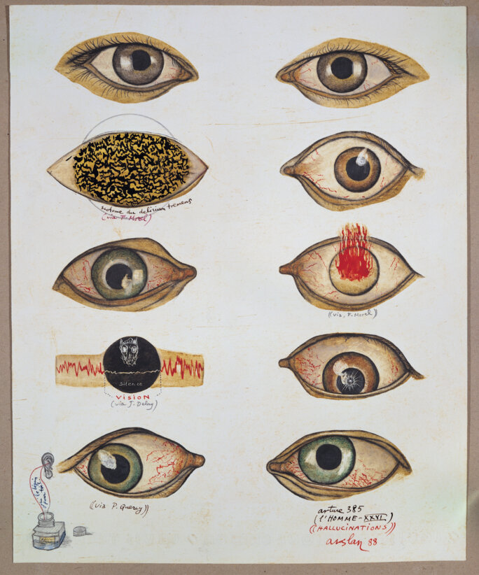 Illustration 3