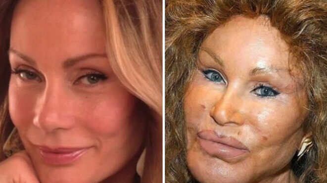 Comment Avoir Les Yeux Bridés Sans Chirurgie