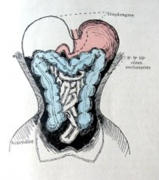 Corset physiologique © Dardelin Corset physiologique © Dardelin