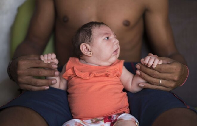 Un enfant frappé par le syndrome Zika, au Brésil le 23 décembre 2015 dans l'Etat de Pernambuc. © Felipe Dana/AP/SIPA