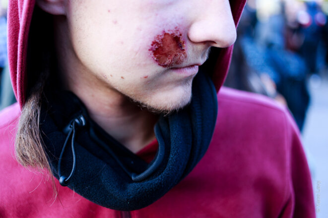 Un jeune raconte sa fin de manifestation place de la Nation samedi 9 avril 2016 © Yann Levy Un jeune raconte sa fin de manifestation place de la Nation samedi 9 avril 2016 © Yann Levy