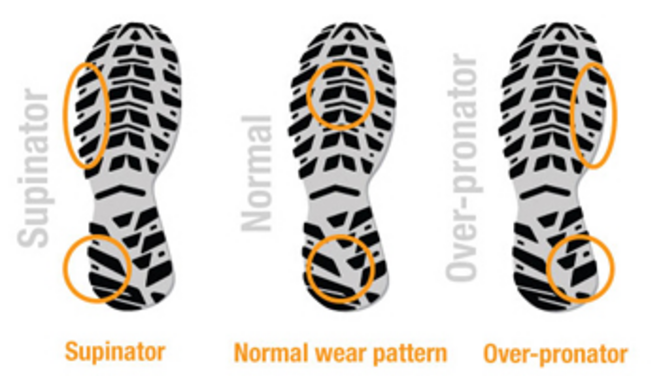 The wear and tear on your shoes can provide clues about how you run. © University of Kansas Medical Center The wear and tear on your shoes can provide clues about how you run. © University of Kansas Medical Center