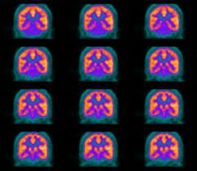 images-petscan
