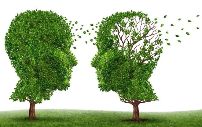 syndrome-maladie-alzheimer