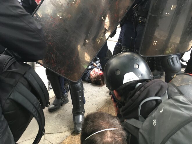 Un manifestant blessé à la tête jeudi dans le cortège parisien © CG