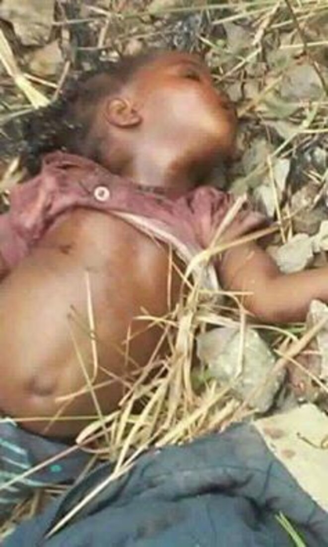 Congo_Fillette victime du pogrom de Sassou dans le Pool Congo_Fillette victime du pogrom de Sassou dans le Pool