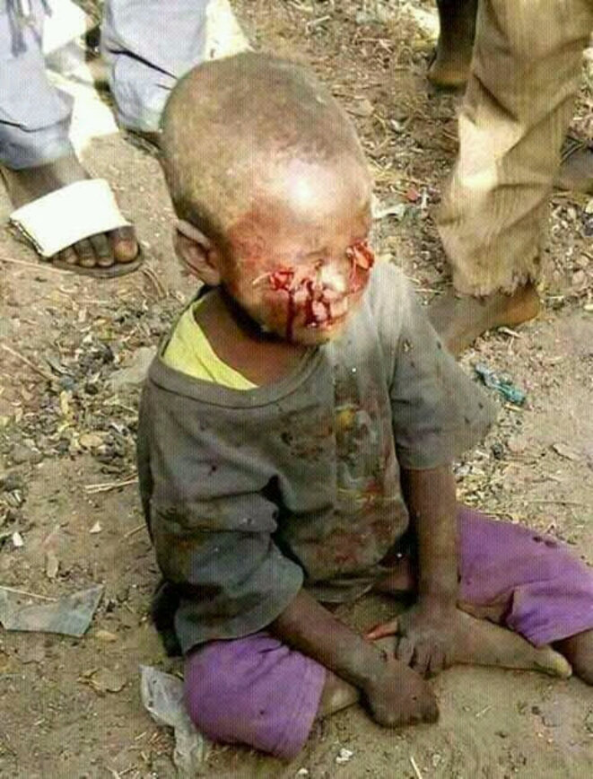 barbarie-sassou-bebe-torture-yeux-creves