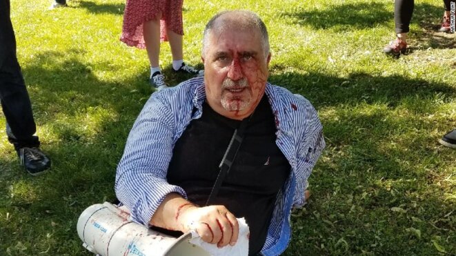 Le 16 mai à Washington les membres de la sécurité d'Erdogan ont frappé des manifestants. Le 16 mai à Washington les membres de la sécurité d'Erdogan ont frappé des manifestants.