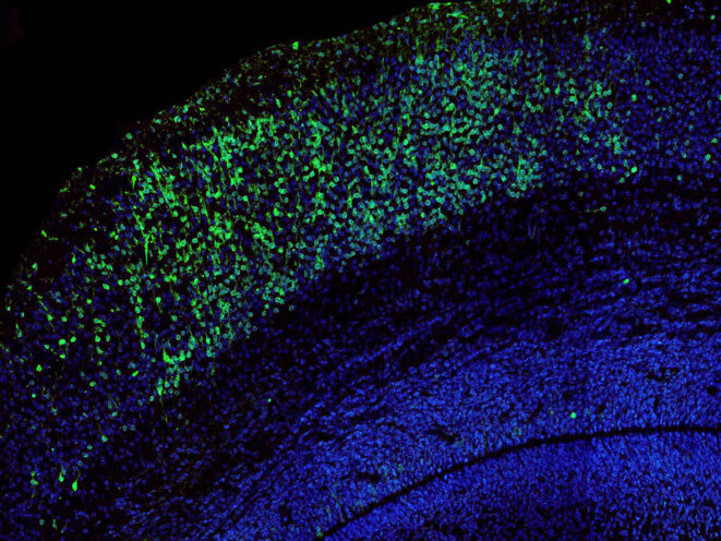 Expression de la cadhérine-23 et de la protocadhérine-15 dans le cortex cérébral auditif d'un embryon de souris. © B Libé-Philippot