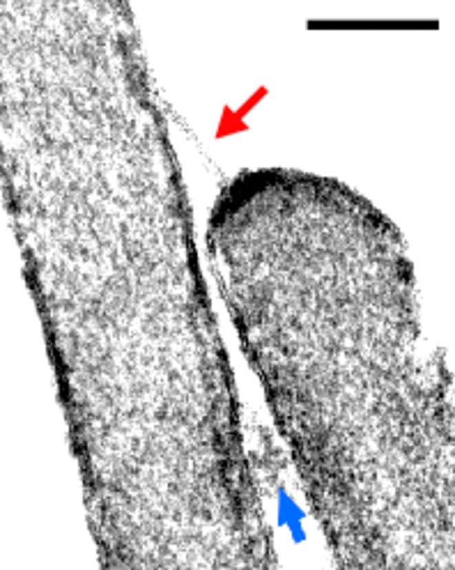 Image de liens entre les microvillosités des cellules sensorielles auditives (ils sont d'environ 200 micromètres). Ces liens sont formés par les protéines que sont la cadhérine-23 et la protocadhérine-15, toutes deux associées à des gènes responsables de surdité. Plus de détails sur www.cochlea.eu/en/hair-cells © R Pujol