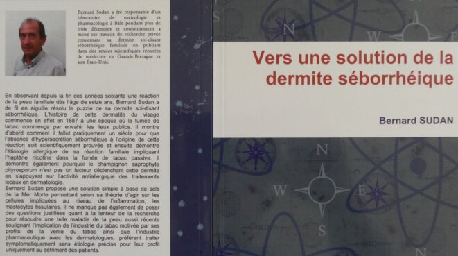 dermiteseborrheique2