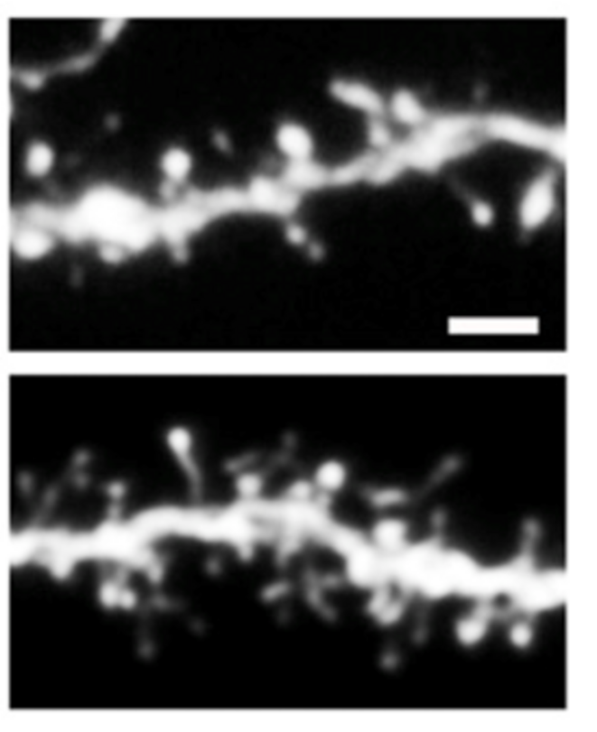 SRGAP2B et SRGAP2C rendent les neurones plus immatures. En haut, une partie de neurone exprimant seulement le gène ancestral SRGAP2 : ces épines dendritiques sont peu nombreuses et grosses. En bas, une partie neurone exprimant le gène ancestral et le gène spécifiquement humain SRGAP2C : ces épines dendritiques sont nombreuses et fines. @Charrier C. & Joshi K. et al., Inhibition of SRGAP2 function by its human-specific paralogs induces neoteny during spine maturation, Cell, 2012. SRGAP2B et SRGAP2C rendent les neurones plus immatures. En haut, une partie de neurone exprimant seulement le gène ancestral SRGAP2 : ces épines dendritiques sont peu nombreuses et grosses. En bas, une partie neurone exprimant le gène ancestral et le gène spécifiquement humain SRGAP2C : ces épines dendritiques sont nombreuses et fines. @Charrier C. & Joshi K. et al., Inhibition of SRGAP2 function by its human-specific paralogs induces neoteny during spine maturation, Cell, 2012.