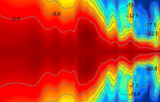 sonogramme
