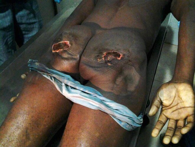 SOS HUMANITAIRE POUR ÉVITER UN MASSACRE PAR LE DICTATEUR OBIANG EN GUINÉE ÉQUATORIALE