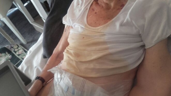 Une résidente, trouvée souillée dans son lit en juin 2017, à la résidence Les Bords de Seine d'Orpea. Une résidente, trouvée souillée dans son lit en juin 2017, à la résidence Les Bords de Seine d'Orpea.