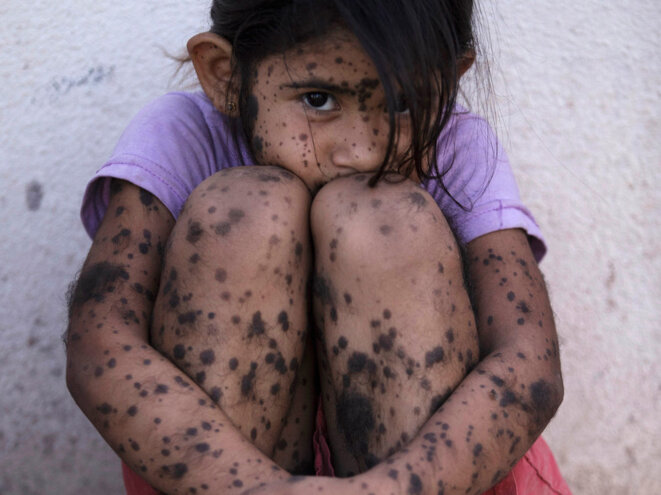 fillette née près d’un champ Monsanto en Argentine, Marco Venaschi, National Geographic