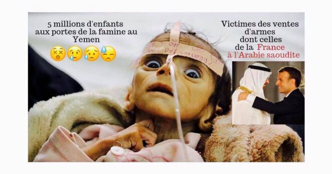 5 millions d'enfants menacés de famine au Yemen, les ventes d'armes en cause © Thierry Paul Valette 5 millions d'enfants menacés de famine au Yemen, les ventes d'armes en cause © Thierry Paul Valette