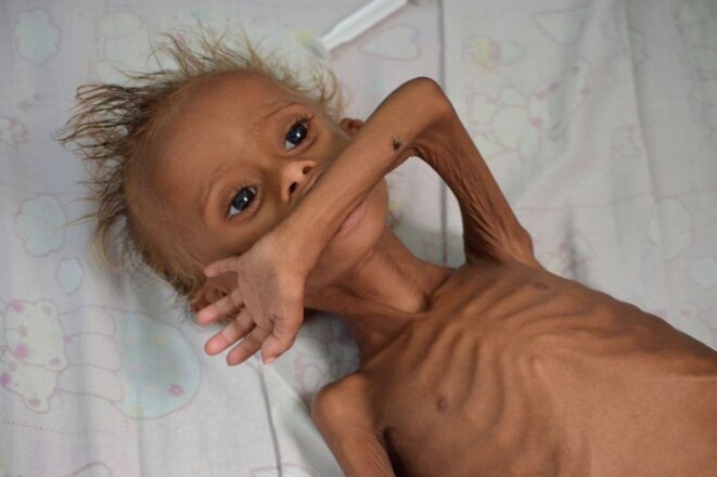 5 millions d'enfants aux portes de la Famine, en cause la vente des armes par la France à l'Arabie saoudite 5 millions d'enfants aux portes de la Famine, en cause la vente des armes par la France à l'Arabie saoudite