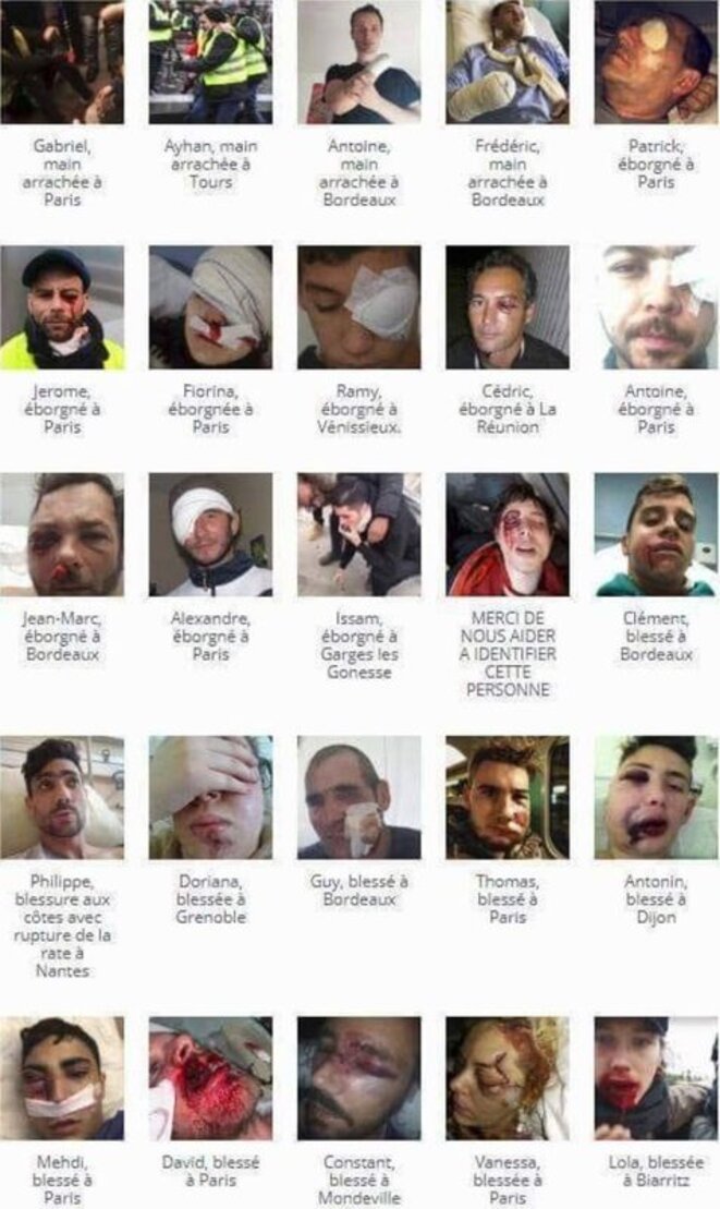 gilets-jaunes-blesses