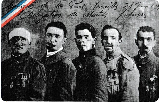 100 ans après Clemenceau, les gueules cassées de Macron.1919–2019. Du prix au mépris.