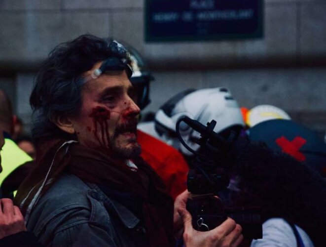 Paris le 05/01/2019. Journaliste blessé par un flashball LBD 40 © Pierre Thomas/IPR Paris le 05/01/2019. Journaliste blessé par un flashball LBD 40 © Pierre Thomas/IPR
