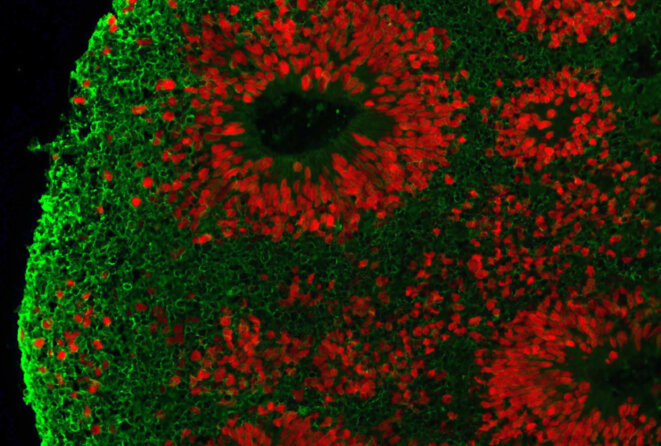 Cerveau modèle : Les organoïdes peuvent donner de meilleures cibles médicamenteuses pour le syndrome du X fragile que les modèles murins. © Avec l'aimable autorisation de Zhexing Wen et Peng Jin Cerveau modèle : Les organoïdes peuvent donner de meilleures cibles médicamenteuses pour le syndrome du X fragile que les modèles murins. © Avec l'aimable autorisation de Zhexing Wen et Peng Jin