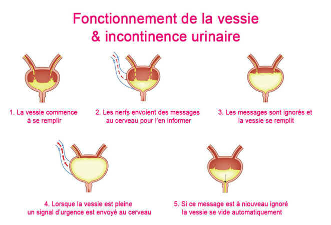 Quelle Est La Différence Entre La Vessie Et Le Sphincter – ZMIF