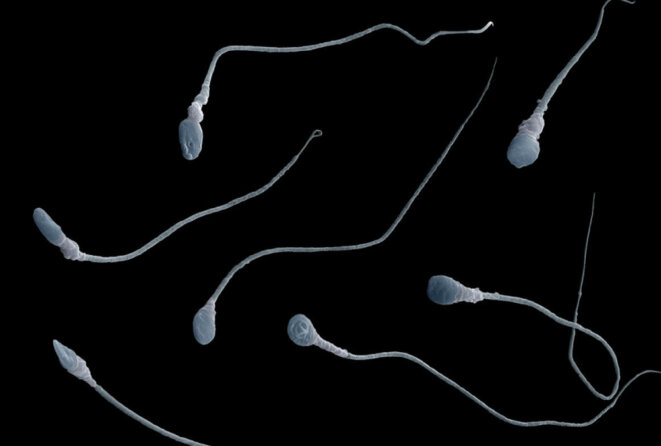 Vue microscopique des spermatozoïdes Comme père : Une mutation "spontanée" observée chez un enfant autiste peut en fait être détectable dans le sperme de son père. © Eye of Science/Science Source Vue microscopique des spermatozoïdes Comme père : Une mutation "spontanée" observée chez un enfant autiste peut en fait être détectable dans le sperme de son père. © Eye of Science/Science Source
