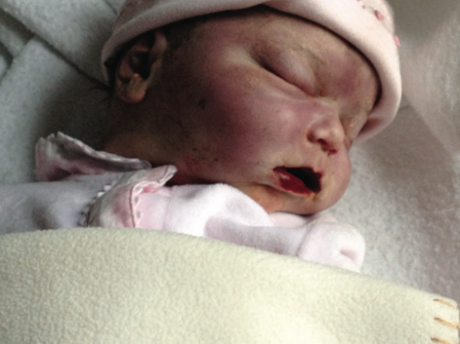 Anencephalie Droits Des Parents Droits Du Bebe Le Club De Mediapart Anencephalie Droits Des Parents Droits Du Bebe Le Club De Mediapart