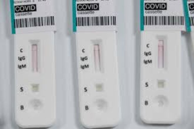 test-se-rologique-covid