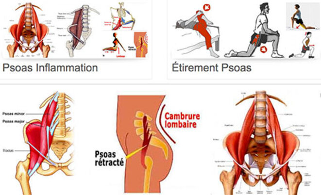 psoas
