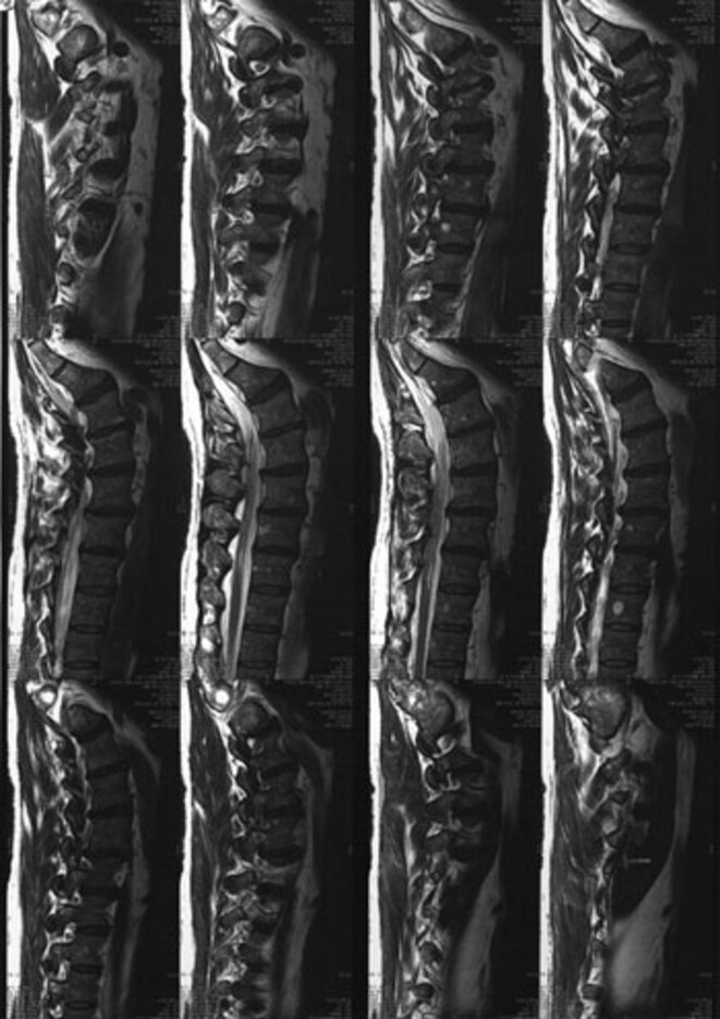 vertebresjjb