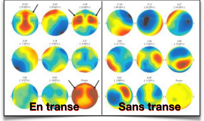 ElectroEncephaloGramme Corinne Sombrun © Flor-Henry Shapiro Sombrun Cogent psychology ElectroEncephaloGramme Corinne Sombrun © Flor-Henry Shapiro Sombrun Cogent psychology