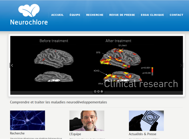 Capture d'écran site Neurochlore Capture d'écran site Neurochlore