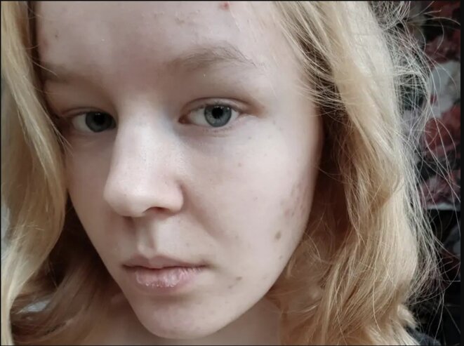 «Je ne vis pas vraiment depuis si longtemps», a écrit Noa Pothoven, 17 ans, dans un dernier post sur les réseaux sociaux. (Noa Pothoven / Facebook) «Je ne vis pas vraiment depuis si longtemps», a écrit Noa Pothoven, 17 ans, dans un dernier post sur les réseaux sociaux. (Noa Pothoven / Facebook)