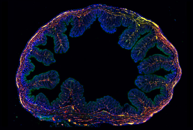 Les neurones et les cellules gliales (rouges, vertes) de l'intestin sont fragiles et s'entremêlent avec d'autres cellules (bleues) du côlon, ce qui les rend difficiles à isoler. © Avec l'aimable autorisation de E. Drokhlyansky, C. Smillie, N. Van Wittenberghe, et L. Caplan / Broad Institute Les neurones et les cellules gliales (rouges, vertes) de l'intestin sont fragiles et s'entremêlent avec d'autres cellules (bleues) du côlon, ce qui les rend difficiles à isoler. © Avec l'aimable autorisation de E. Drokhlyansky, C. Smillie, N. Van Wittenberghe, et L. Caplan / Broad Institute